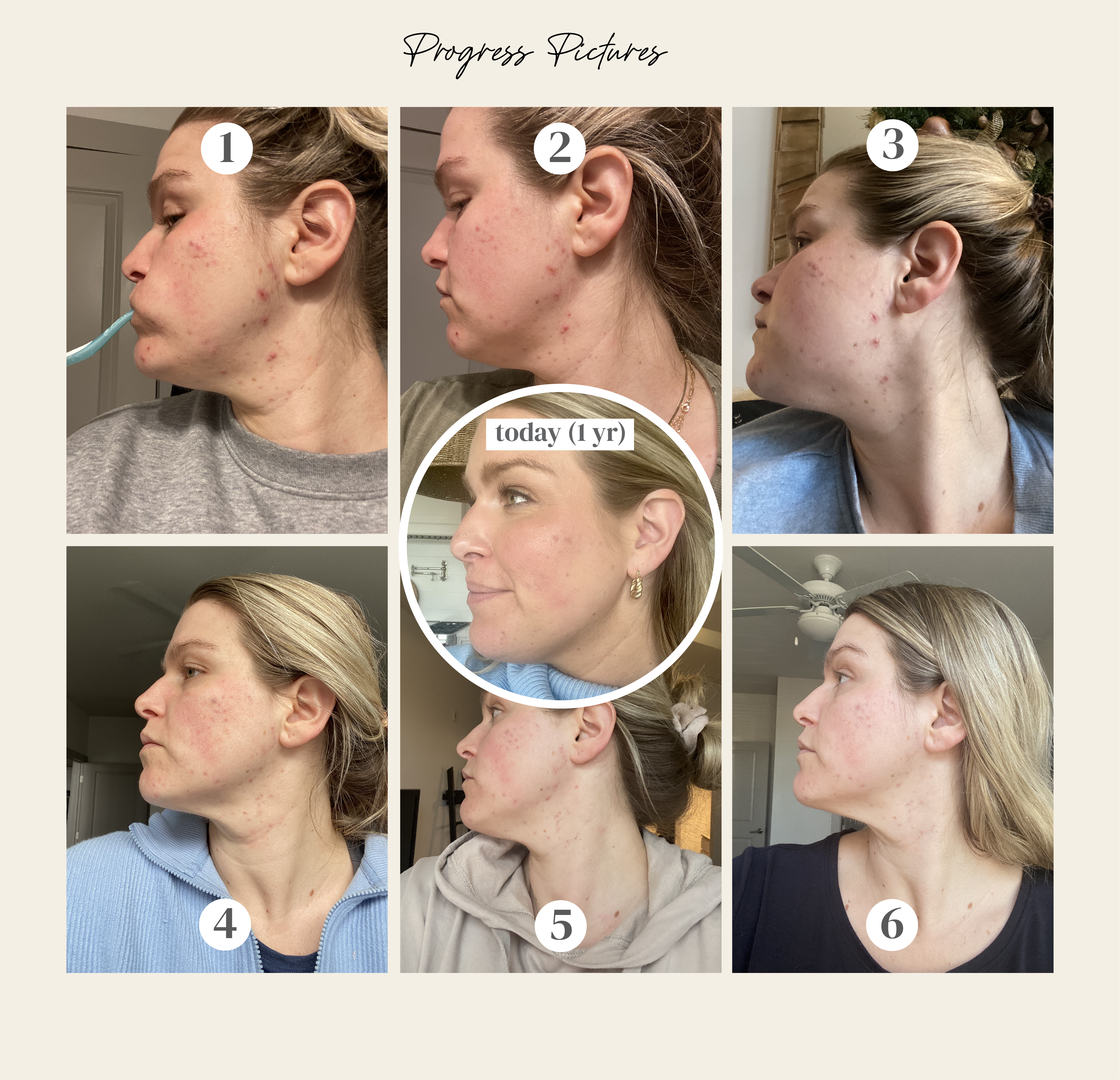 the bean protocol before and after photos